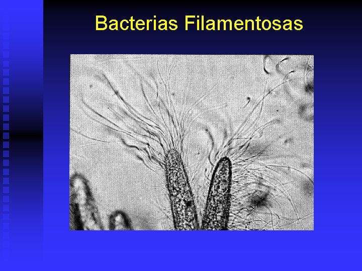 Bacterias Filamentosas 