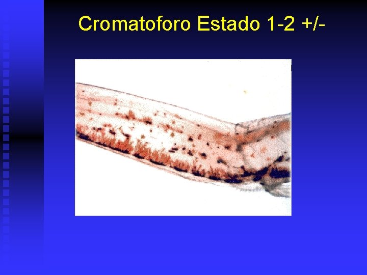 Cromatoforo Estado 1 -2 +/- 