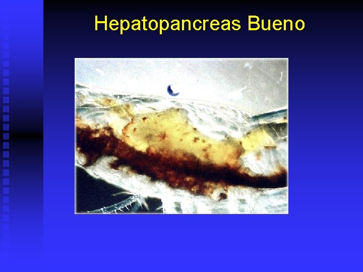 Hepatopancreas Bueno 