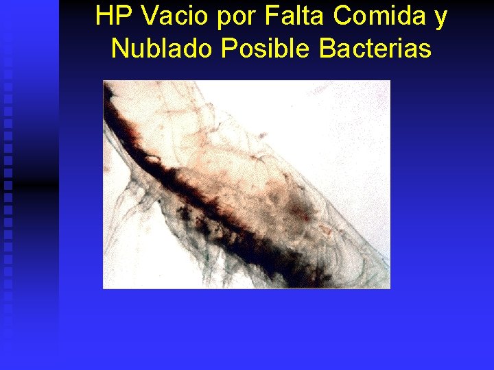 HP Vacio por Falta Comida y Nublado Posible Bacterias 