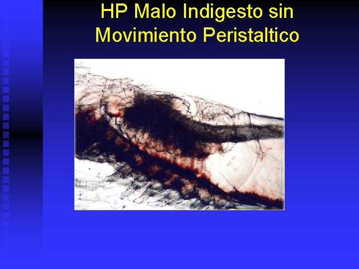 HP Malo Indigesto sin Movimiento Peristaltico 
