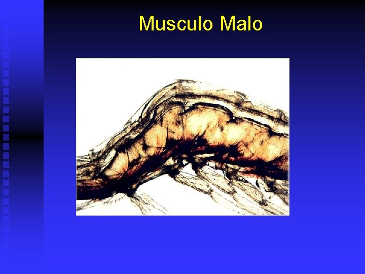 Musculo Malo 