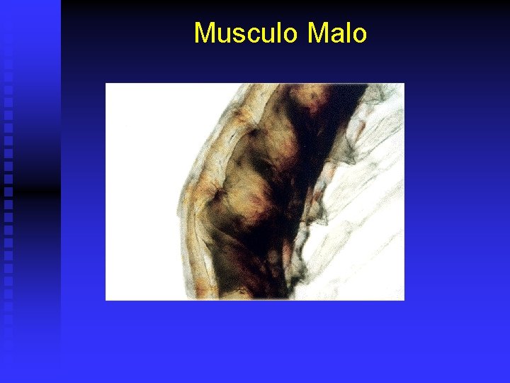 Musculo Malo 