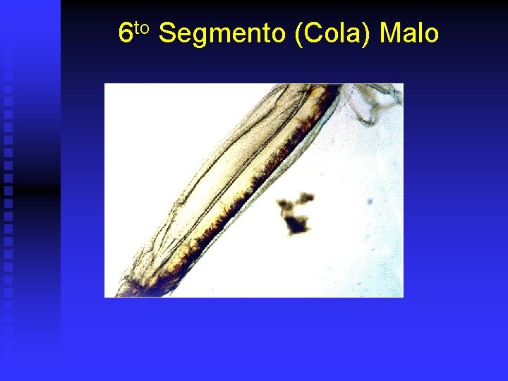 6 to Segmento (Cola) Malo 