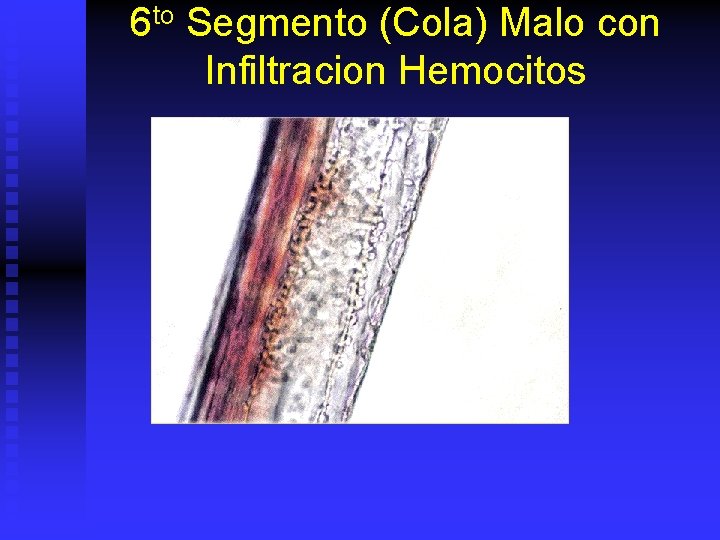 6 to Segmento (Cola) Malo con Infiltracion Hemocitos 
