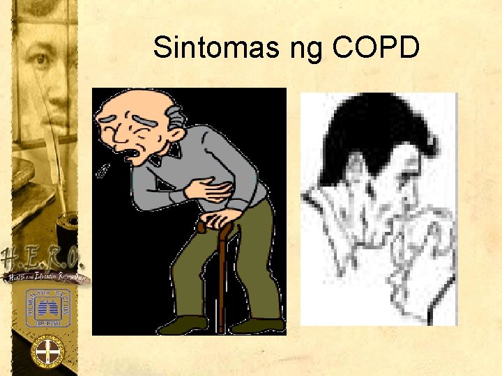 Sintomas ng COPD 