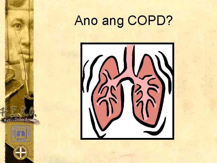 Ano ang COPD? 