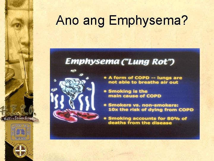 Ano ang Emphysema? 