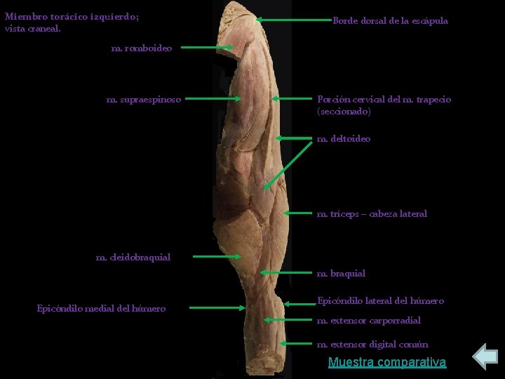Miembro torácico izquierdo; vista craneal. Borde dorsal de la escápula m. romboideo m. supraespinoso