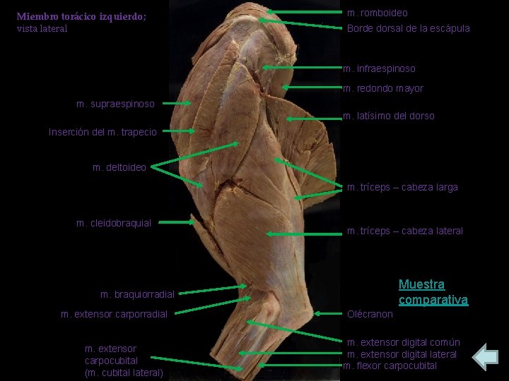 Miembro torácico izquierdo; vista lateral m. romboideo Borde dorsal de la escápula m. infraespinoso