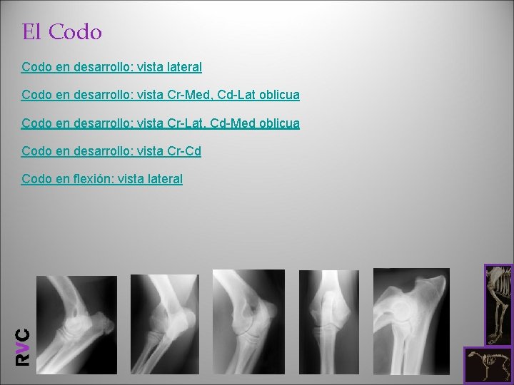 El Codo en desarrollo: vista lateral Codo en desarrollo: vista Cr-Med, Cd-Lat oblicua Codo