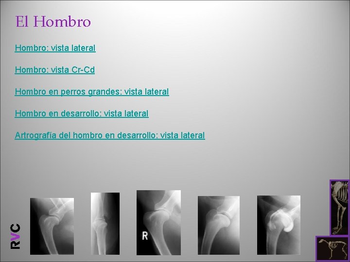 El Hombro: vista lateral Hombro: vista Cr-Cd Hombro en perros grandes: vista lateral Hombro