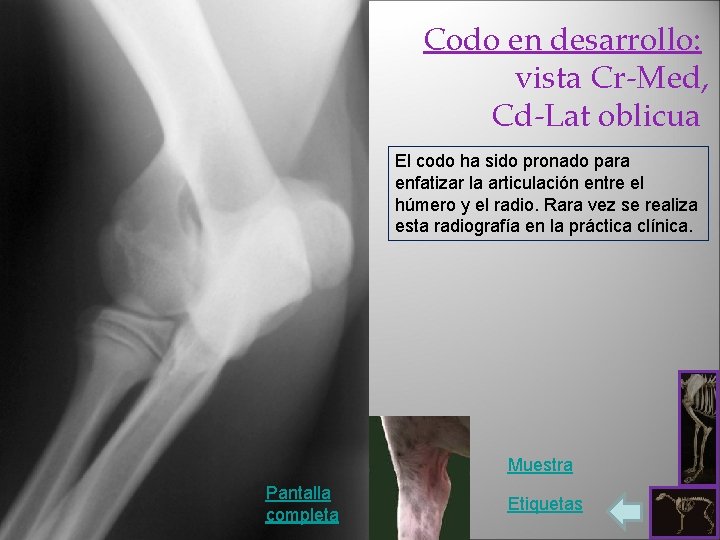 Codo en desarrollo: vista Cr-Med, Cd-Lat oblicua El codo ha sido pronado para enfatizar