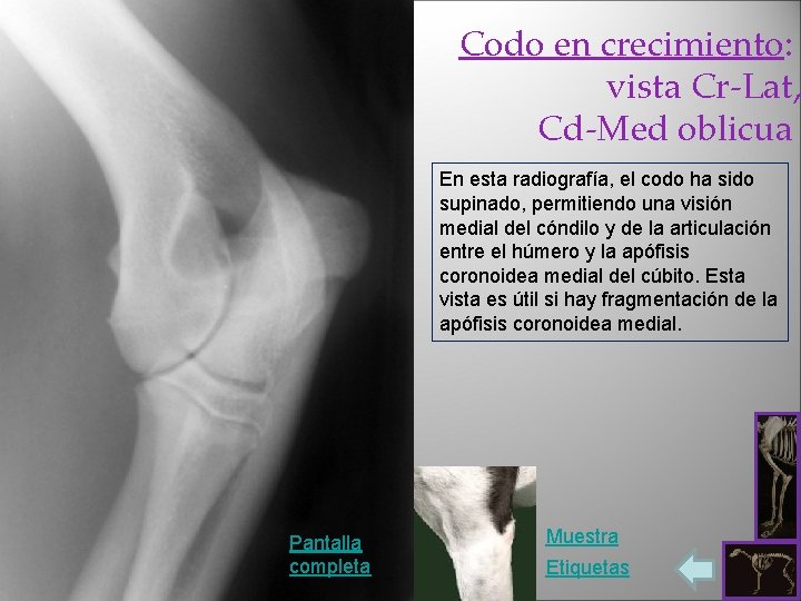 Codo en crecimiento: vista Cr-Lat, Cd-Med oblicua En esta radiografía, el codo ha sido