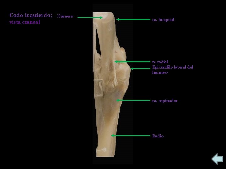 Codo izquierdo; vista craneal Húmero m. braquial n. radial Epicóndilo lateral del húmero m.