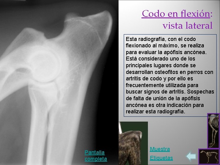 Codo en flexión: vista lateral Esta radiografía, con el codo flexionado al máximo, se