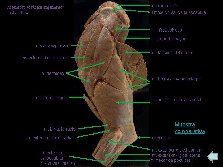 Miembro torácico izquierdo; vista lateral m. romboideo Borde dorsal de la escápula m. infraespinoso