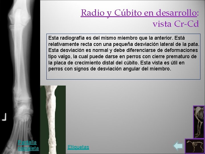 Radio y Cúbito en desarrollo: vista Cr-Cd Esta radiografía es del mismo miembro que