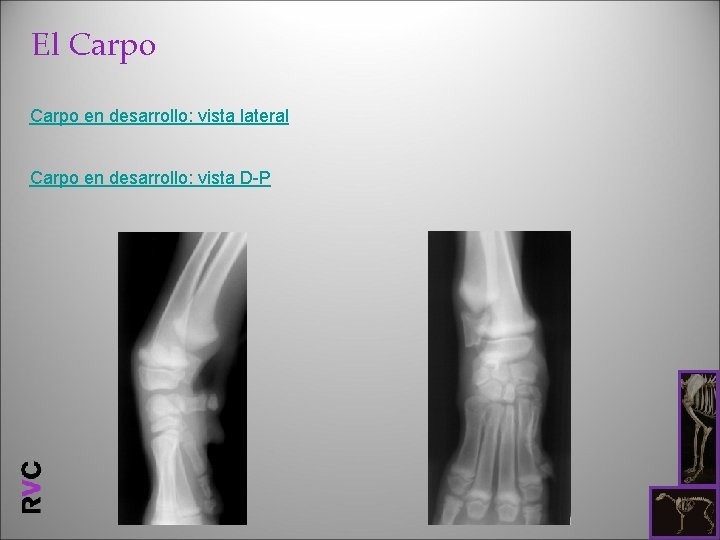 El Carpo en desarrollo: vista lateral Carpo en desarrollo: vista D-P 
