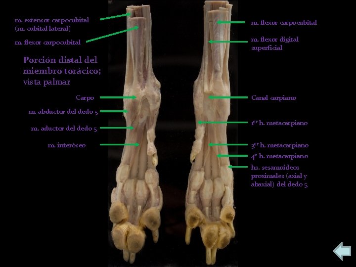 m. extensor carpocubital (m. cubital lateral) m. flexor carpocubital m. flexor digital superficial Porción