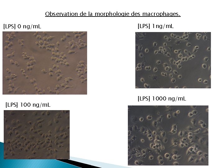 Observation de la morphologie des macrophages. [LPS] 0 ng/m. L [LPS] 1000 ng/m. L