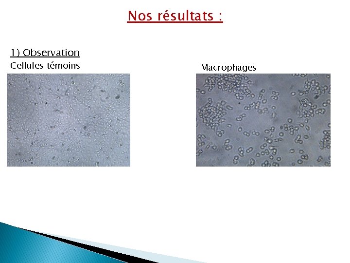 Nos résultats : 1) Observation Cellules témoins Macrophages 