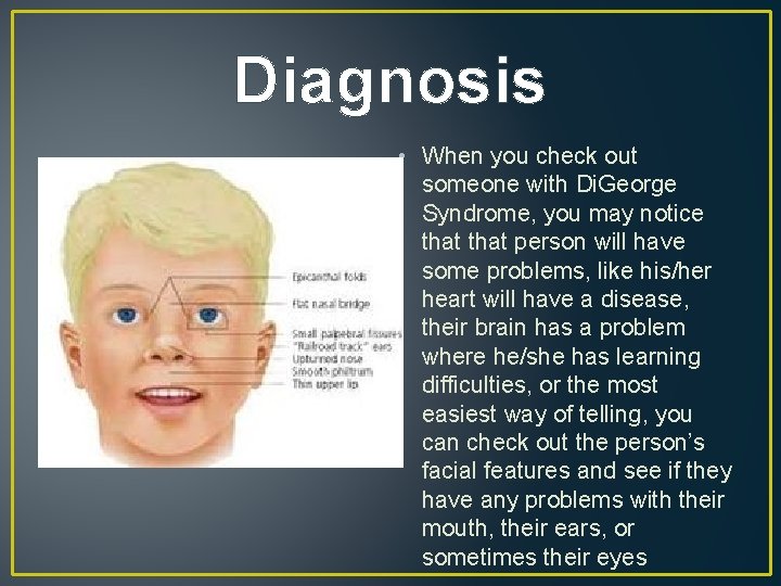 Diagnosis • When you check out someone with Di. George Syndrome, you may notice