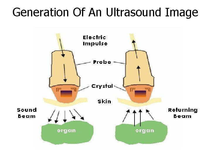 Generation Of An Ultrasound Image 