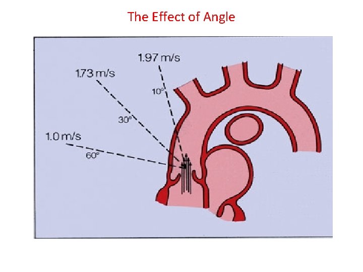 The Effect of Angle 