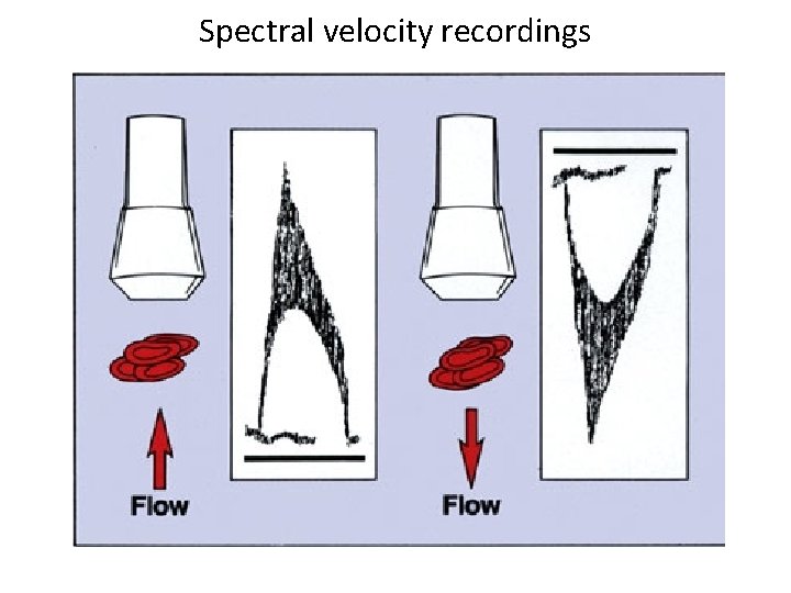 Spectral velocity recordings 