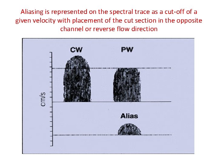 Aliasing is represented on the spectral trace as a cut-off of a given velocity