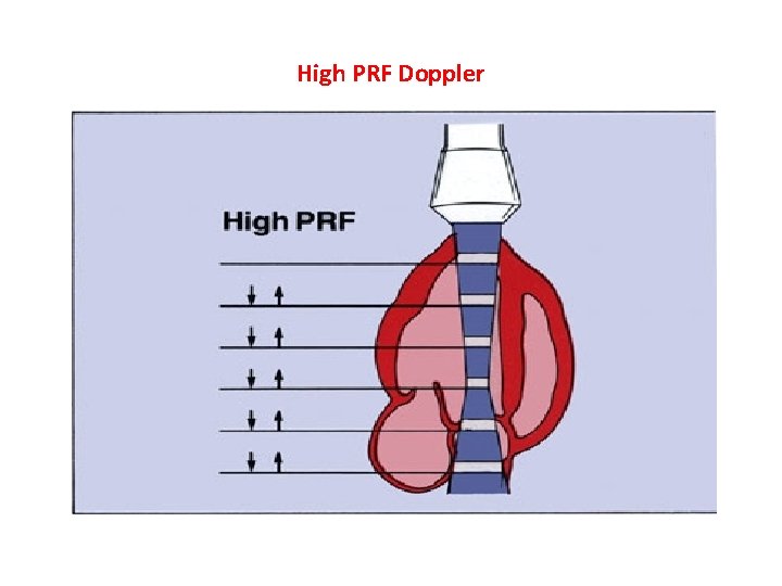 High PRF Doppler 