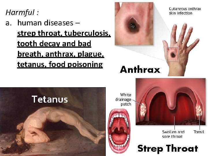 Harmful : a. human diseases – strep throat, tuberculosis, tooth decay and bad breath,