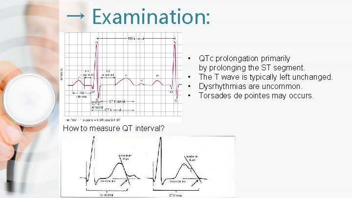 → Examination: • • How to measure QT interval? QTc prolongation primarily by prolonging