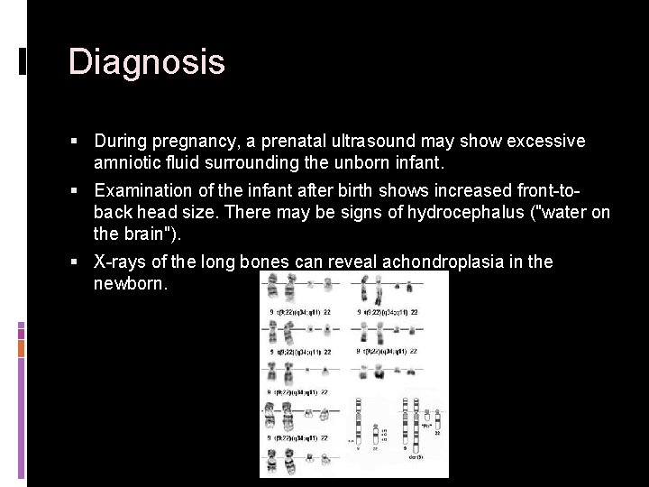Diagnosis § During pregnancy, a prenatal ultrasound may show excessive amniotic fluid surrounding the