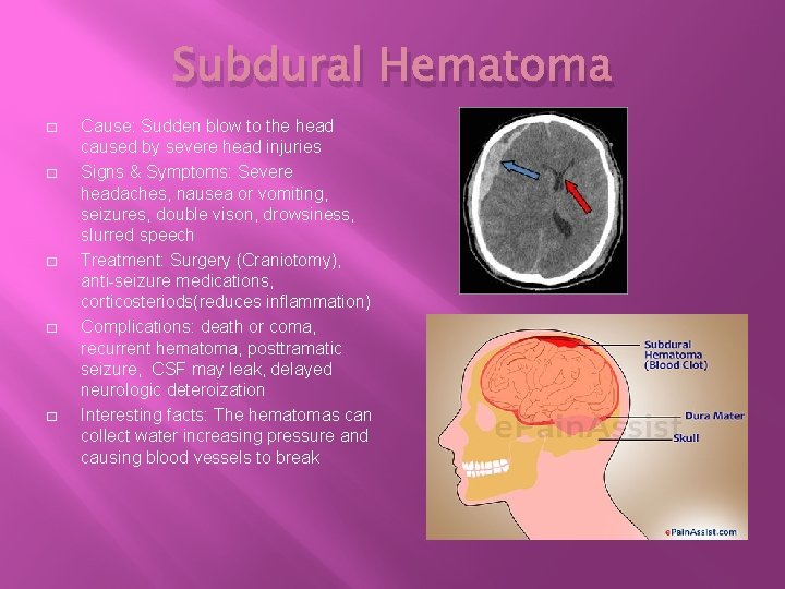 Subdural Hematoma � � � Cause: Sudden blow to the head caused by severe