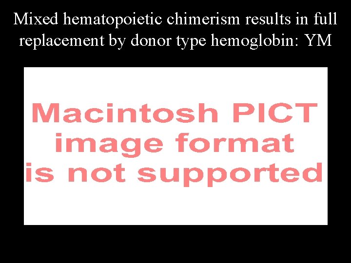 Mixed hematopoietic chimerism results in full replacement by donor type hemoglobin: YM 