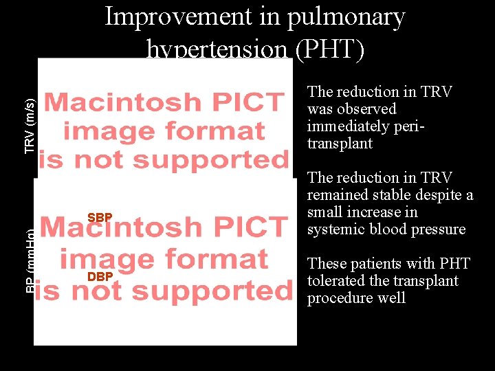 Improvement in pulmonary hypertension (PHT) TRV (m/s) • The reduction in TRV was observed