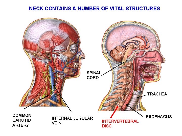 NECK CONTAINS A NUMBER OF VITAL STRUCTURES SPINAL CORD TRACHEA COMMON CAROTID ARTERY INTERNAL