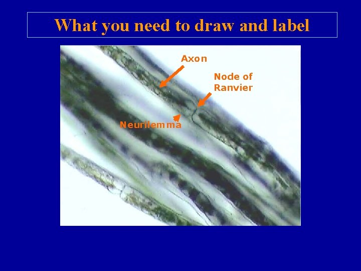 What you need to draw and label Axon Node of Ranvier Neurilemma 