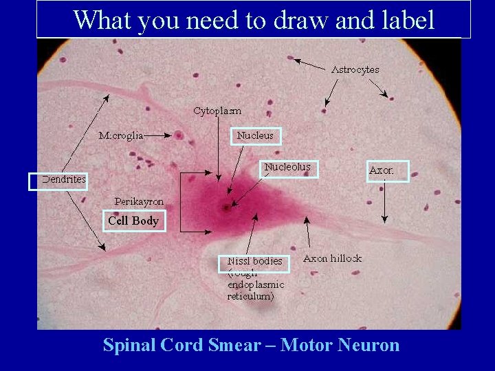 What you need to draw and label Cell Body Spinal Cord Smear – Motor