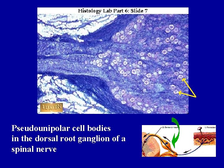 Pseudounipolar cell bodies in the dorsal root ganglion of a spinal nerve 