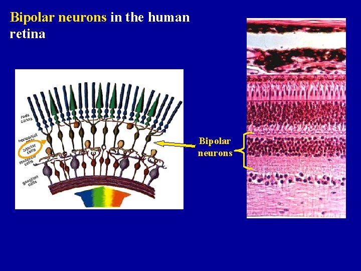 Bipolar neurons in the human retina Bipolar neurons 