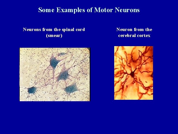 Some Examples of Motor Neurons from the spinal cord (smear) Neuron from the cerebral