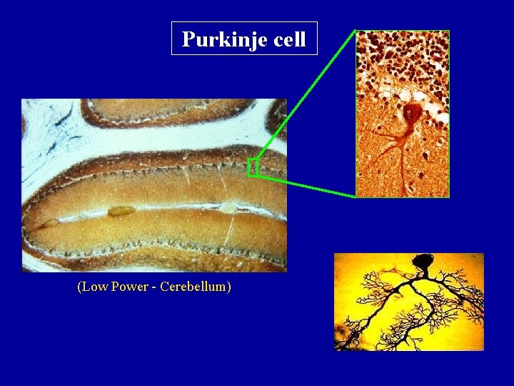 Purkinje cell (Low Power - Cerebellum) 