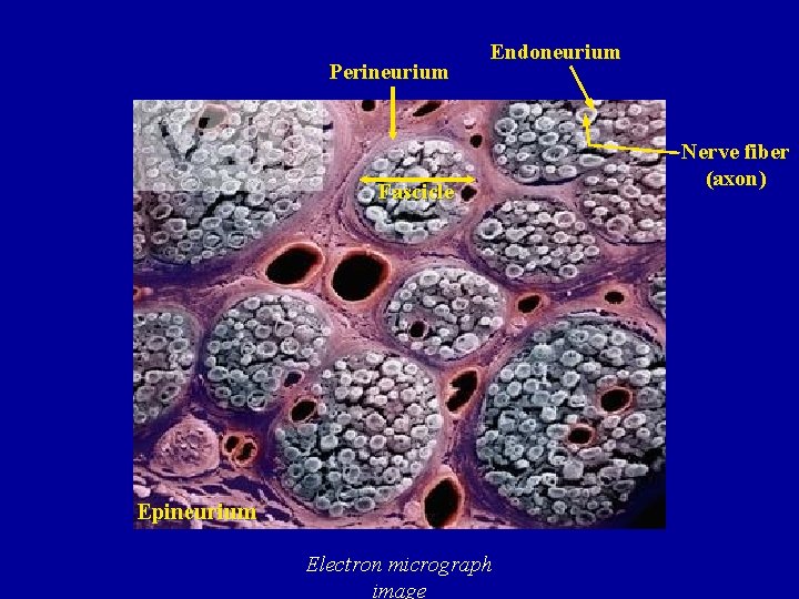 Perineurium Endoneurium Fascicle Epineurium Electron micrograph image Nerve fiber (axon) 