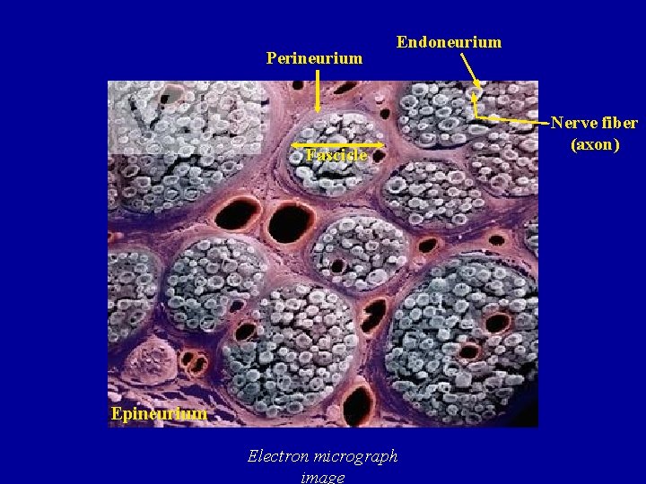 Perineurium Endoneurium Fascicle Epineurium Electron micrograph image Nerve fiber (axon)  Perineurium Endoneurium Fascicle Epineurium Electron micrograph image Nerve fiber (axon)