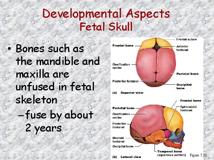 Developmental Aspects Fetal Skull • Bones such as the mandible and maxilla are unfused