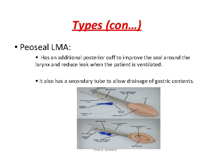 Types (con…) • Peoseal LMA: § Has an additional posterior cuff to improve the