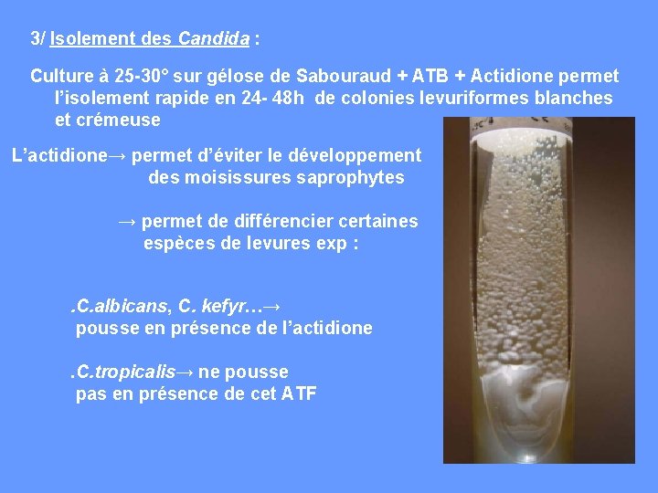 3/ Isolement des Candida : Culture à 25 -30° sur gélose de Sabouraud +